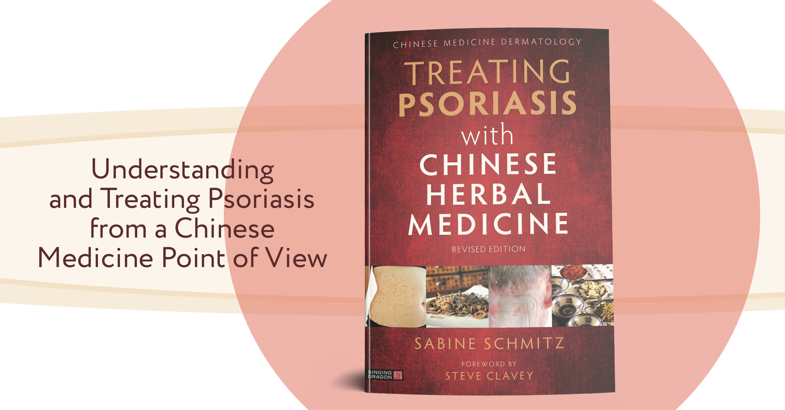 Treating Psoriasis with Chinese Herbal Medicine - Singing Dragon Blog